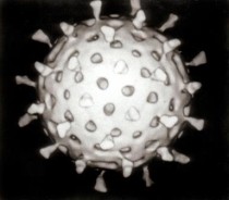 Rotavirus. Bild: Graham Beards. GNU Free Documentation License
